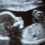 Arkansas governor signs legislation banning almost all abortions