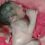 Baby born with third arm growing from its back in ‘extremely rare’ miracle birth